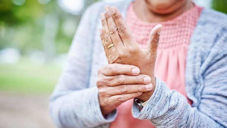 women with arthritis in the hand