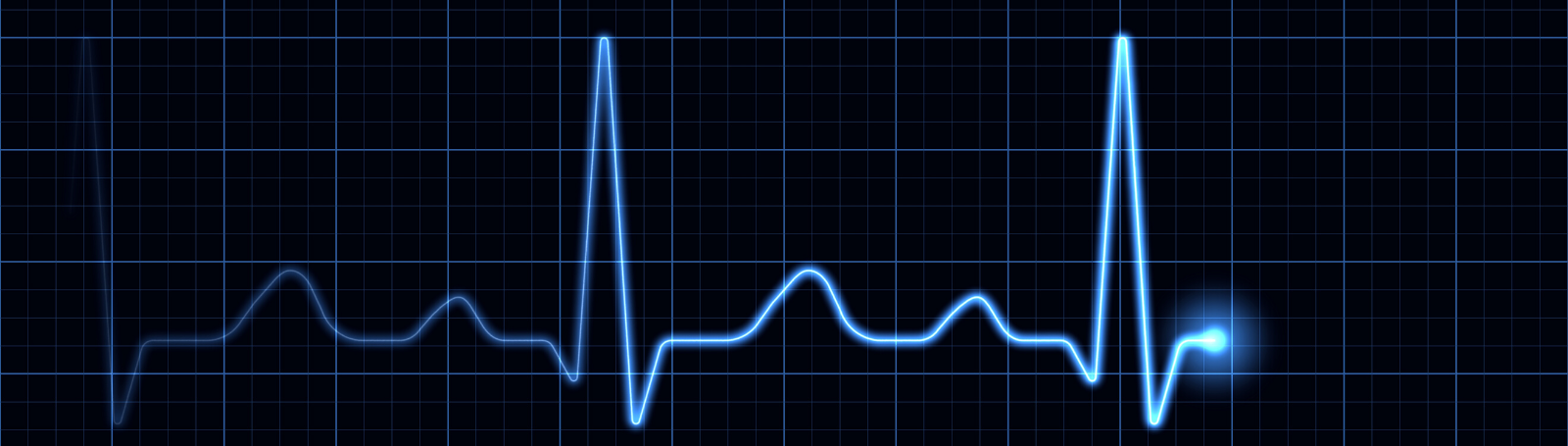 electrocardiogram on computer screen