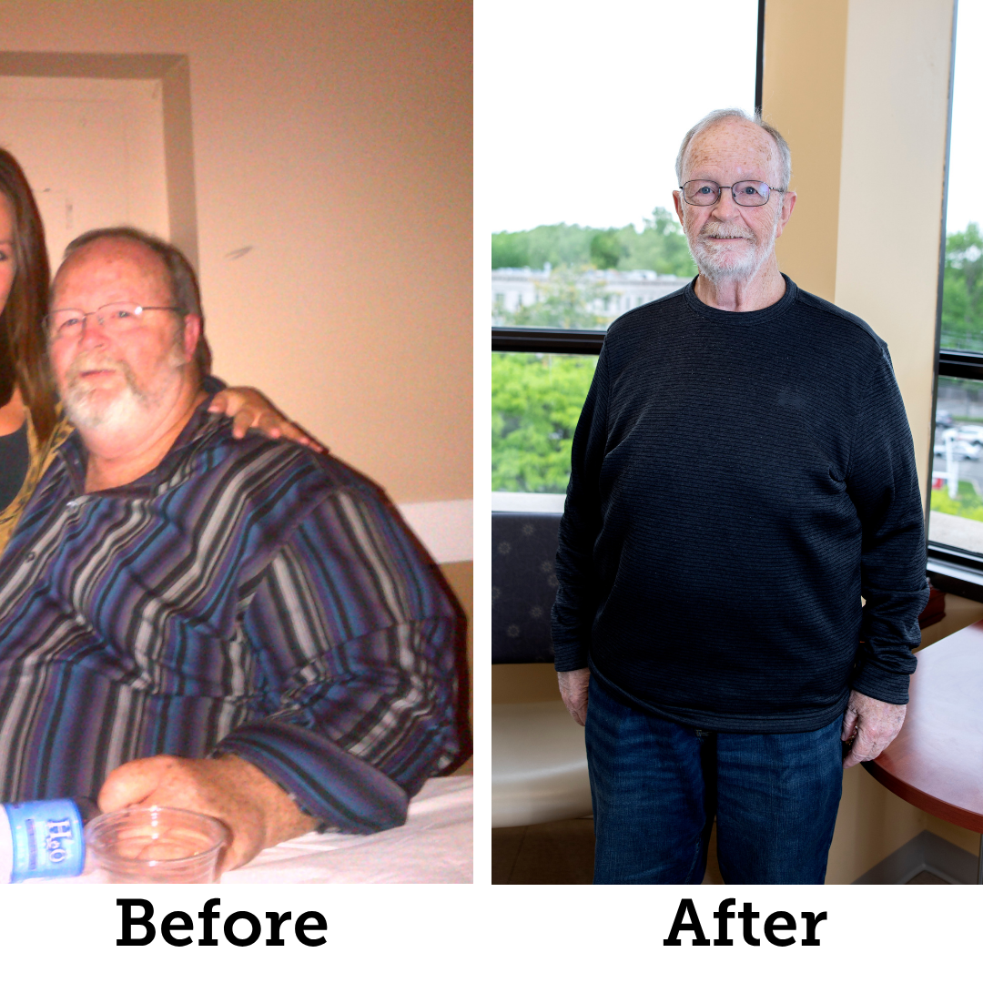Bruce Young, before and after his weight loss