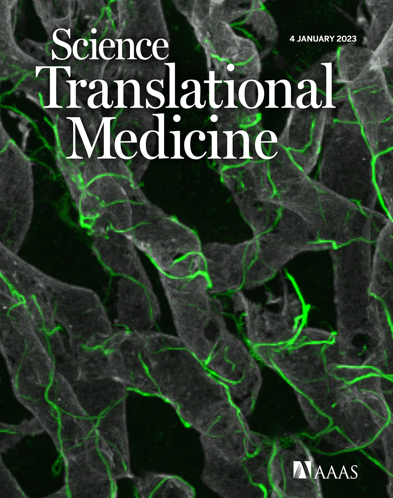 Decreased serotonin transporter activity in the mitral valve contributes to progression of degenerative mitral regurgitation