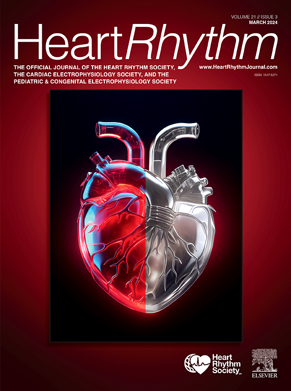 heart rhythm