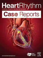 heart rhythm case reports cover