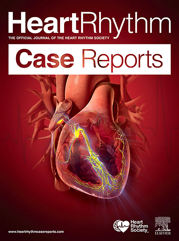 Heart Rhythm Case Reports