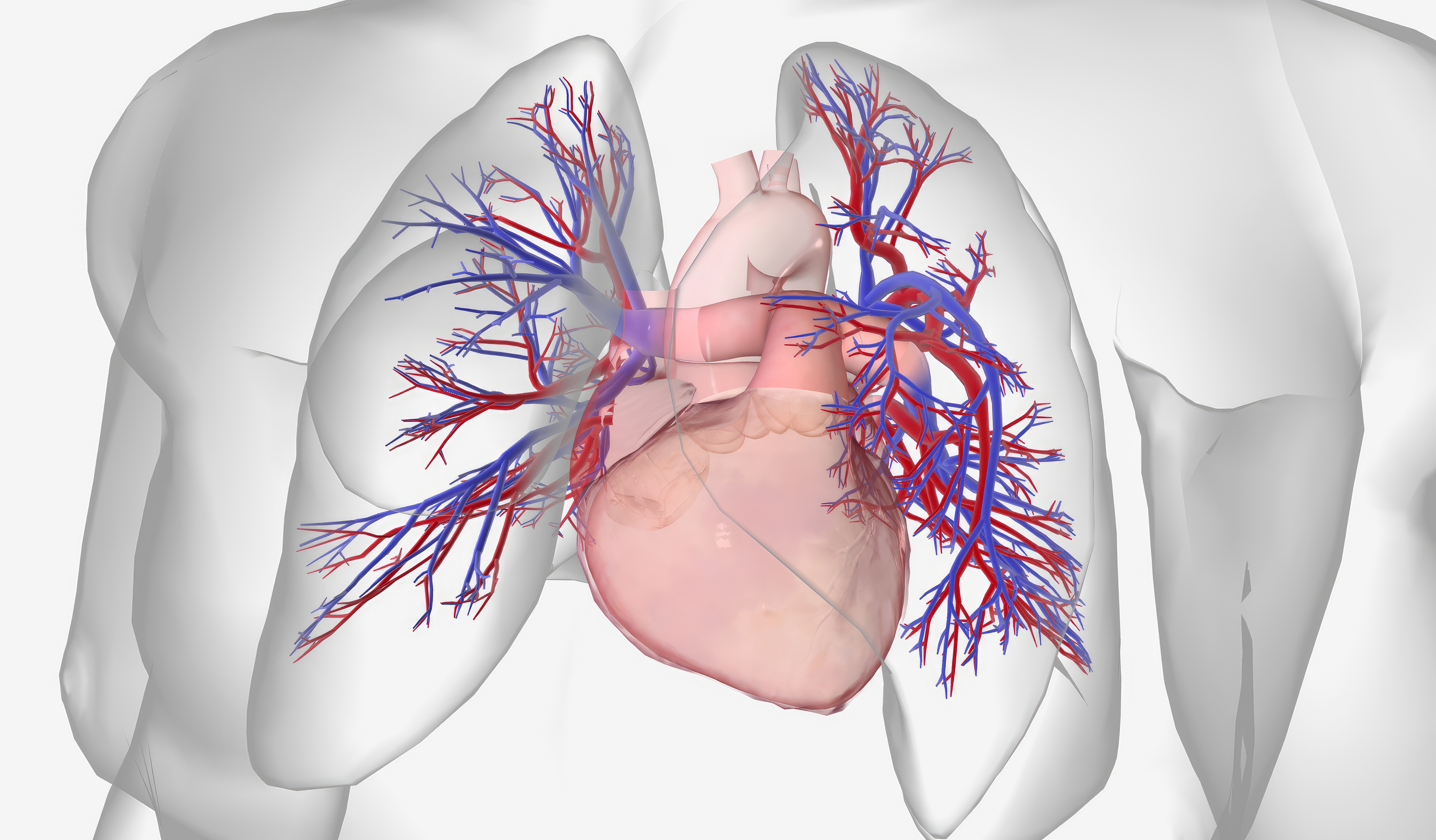 Pulmonary arterial hypertension