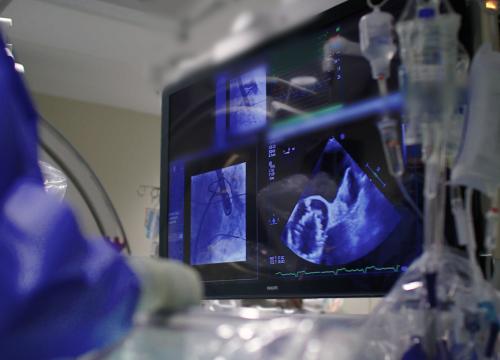 physician looking at screen while performing Left atrial appendage closure