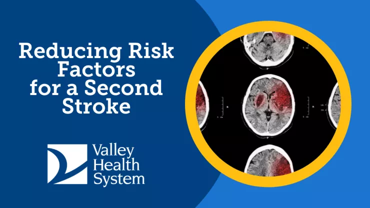stroke risk factors