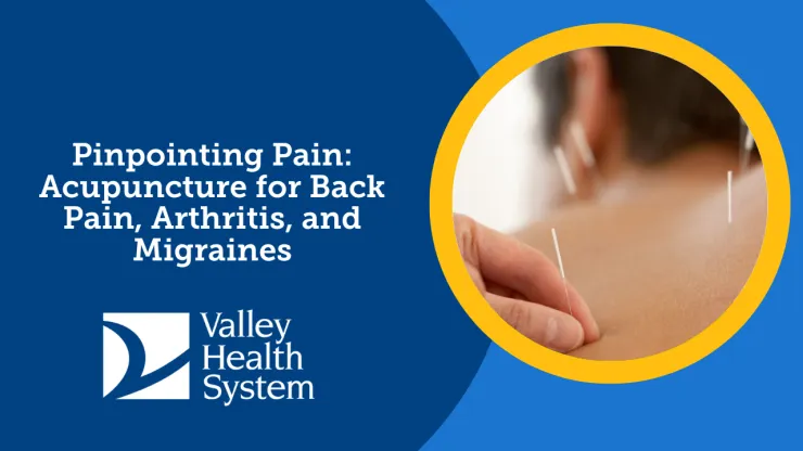 Pinpointing Pain: Acupuncture for Back Pain, Arthritis, and Migraines