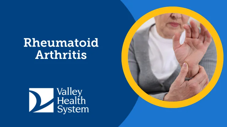 Rheumatoid Arthritis
