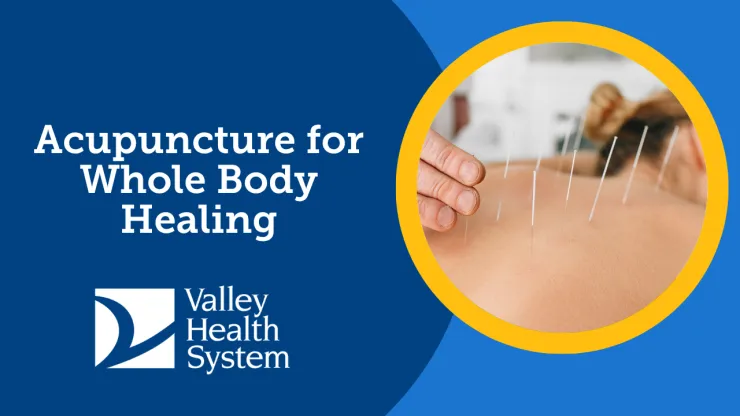 woman receiving acupuncture on her back