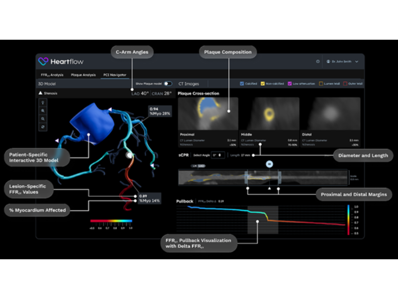 Heartflow FCI Navigator